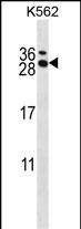 Rabbit Polyclonal Antibody to RCAN3