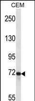 Rabbit Polyclonal Antibody to PTPRE (N-term)