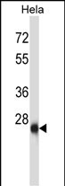 Rabbit Polyclonal Antibody to ZIC4 (N-term)
