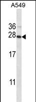 Rabbit Polyclonal Antibody to POLR2E (N-term)