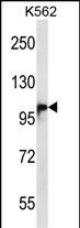 Rabbit Polyclonal Antibody to DSG1