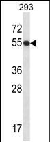 Rabbit Polyclonal Antibody to GTF2E1 (N-term)