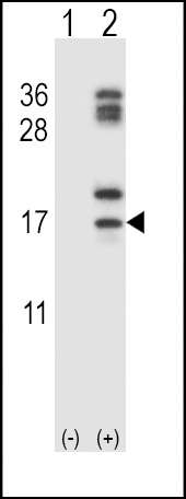Rabbit Polyclonal Antibody to CLC