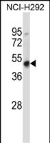 Rabbit Polyclonal Antibody to Mouse Hoxd3