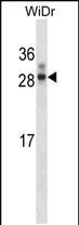 Rabbit Polyclonal Antibody to Rat Hoxa7 (N-term)