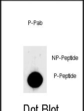 Rabbit Polyclonal Antibody to Phospho-LIN28(S134)