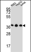 Rabbit Polyclonal Antibody to HNRPDL