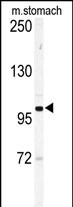 Rabbit Polyclonal Antibody to Eph Receptor A6