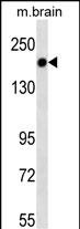 Mouse Monoclonal Antibody to TSC1