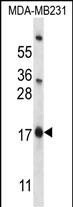 Rabbit Polyclonal Antibody to PHLDA2