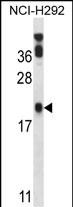 Rabbit Polyclonal Antibody to PERP