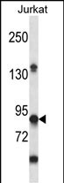 Rabbit Polyclonal Antibody to PTPRN