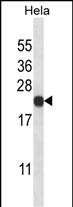 Rabbit Polyclonal Antibody to PSMB5