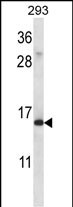 Rabbit Polyclonal Antibody to RPS19