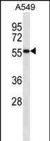 Rabbit Polyclonal Antibody to SEMG1 (N-term)