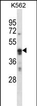 Rabbit Polyclonal Antibody to ARC (N-term)