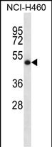 Rabbit Polyclonal Antibody to SOCS4