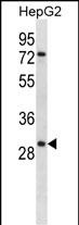Rabbit Polyclonal Antibody to KLK10 (N-term)