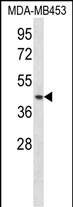 Rabbit Polyclonal Antibody to RING1 (N-term)