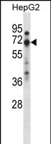 Rabbit Polyclonal Antibody to ZNF395