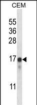 Rabbit Polyclonal Antibody to FREQ (N-term)