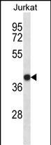 Rabbit Polyclonal Antibody to SET (N-term)