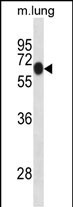 Rabbit Polyclonal Antibody to Mouse Dyrk1b