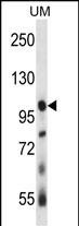 Rabbit Polyclonal Antibody to USP4 (N-term)