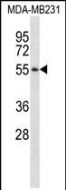 Rabbit Polyclonal Antibody to PGA3 (N-term)