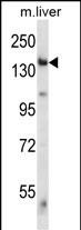 Rabbit Polyclonal Antibody to Mouse Eif2ak4
