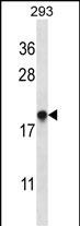 Rabbit Polyclonal Antibody to TMM85 (N-term)