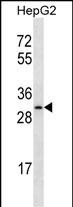 Rabbit Polyclonal Antibody to OR4C12