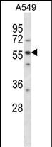 Rabbit Polyclonal Antibody to LSM14A