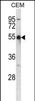 Rabbit Polyclonal Antibody to KCNA2