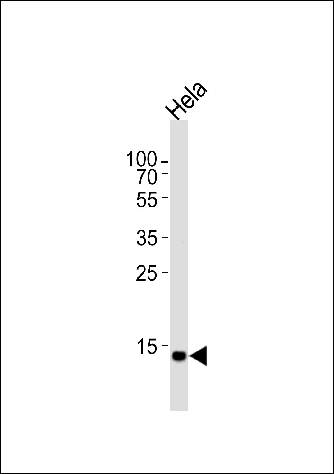 Rabbit Polyclonal Antibody to UBE2D2