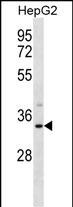 Rabbit Polyclonal Antibody to SULT1A3