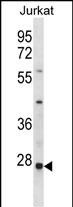 Rabbit Polyclonal Antibody to HTATIP2 (N-term)
