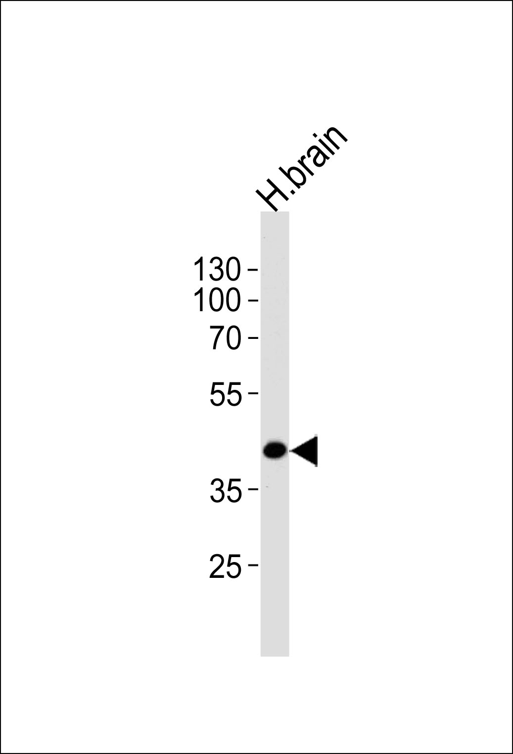 Rabbit Polyclonal Antibody to SEPT5 (N-term)