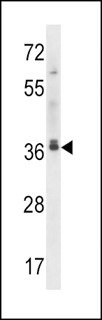 Rabbit Polyclonal Antibody to MAPRE2 (N-term)