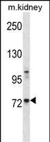 Rabbit Polyclonal Antibody to Mouse Tec