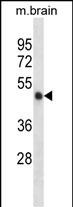 Rabbit Polyclonal Antibody to Mouse Camk2a