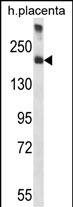 Rabbit Polyclonal Antibody to A2M