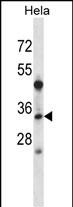 Rabbit Polyclonal Antibody to LAT2