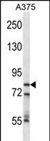 Rabbit Polyclonal Antibody to CPSF3