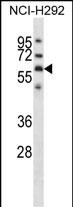Rabbit Polyclonal Antibody to GPC3