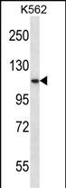 Rabbit Polyclonal Antibody to PCSK6