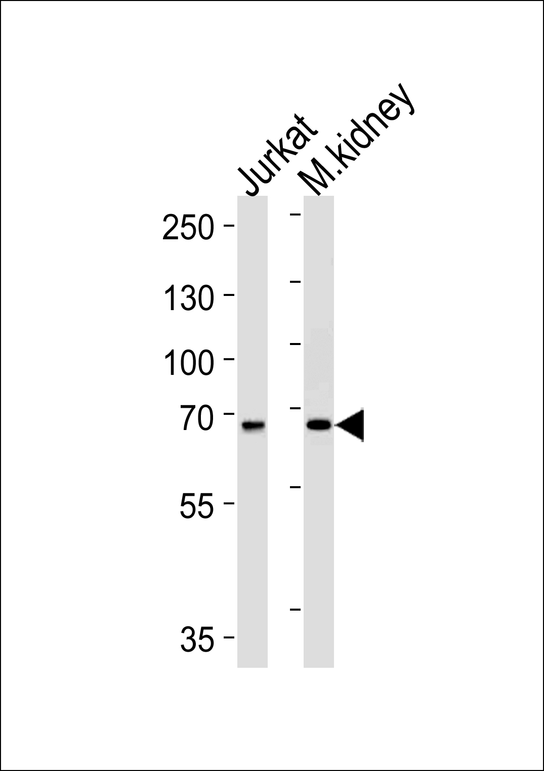Rabbit Polyclonal Antibody to TCF12 (N-term)