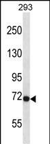 Rabbit Polyclonal Antibody to Mouse Fgfr3
