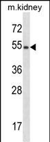 Rabbit Polyclonal Antibody to Mouse Frk