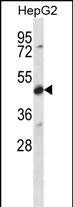 Rabbit Polyclonal Antibody to CDR2